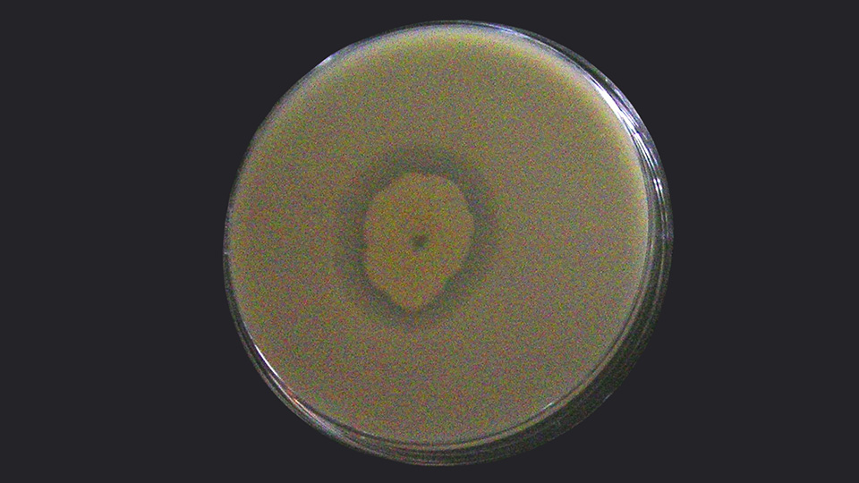 Bacterial activity
